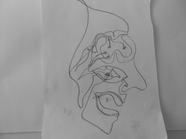Dibujo